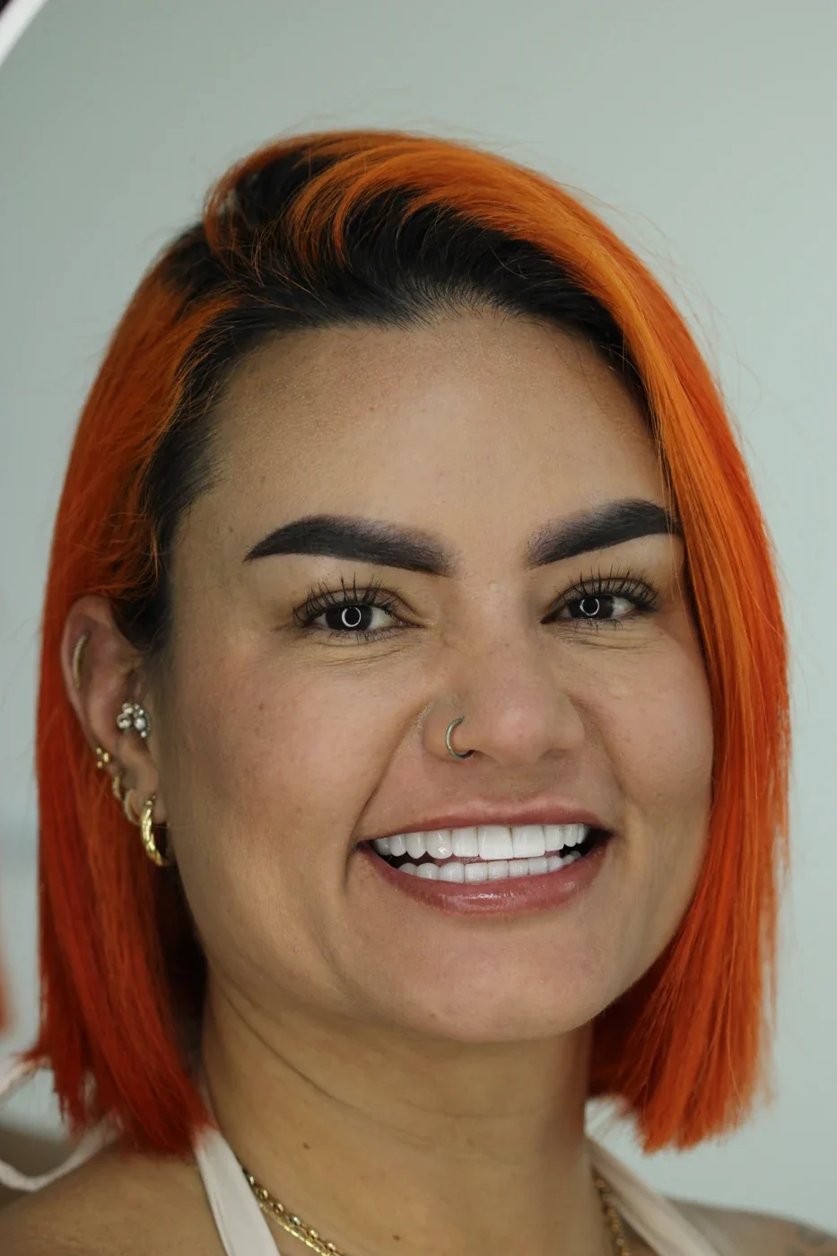Sonrisa de una paciente de la Dra. Mariana Barco, publicada con autorización.